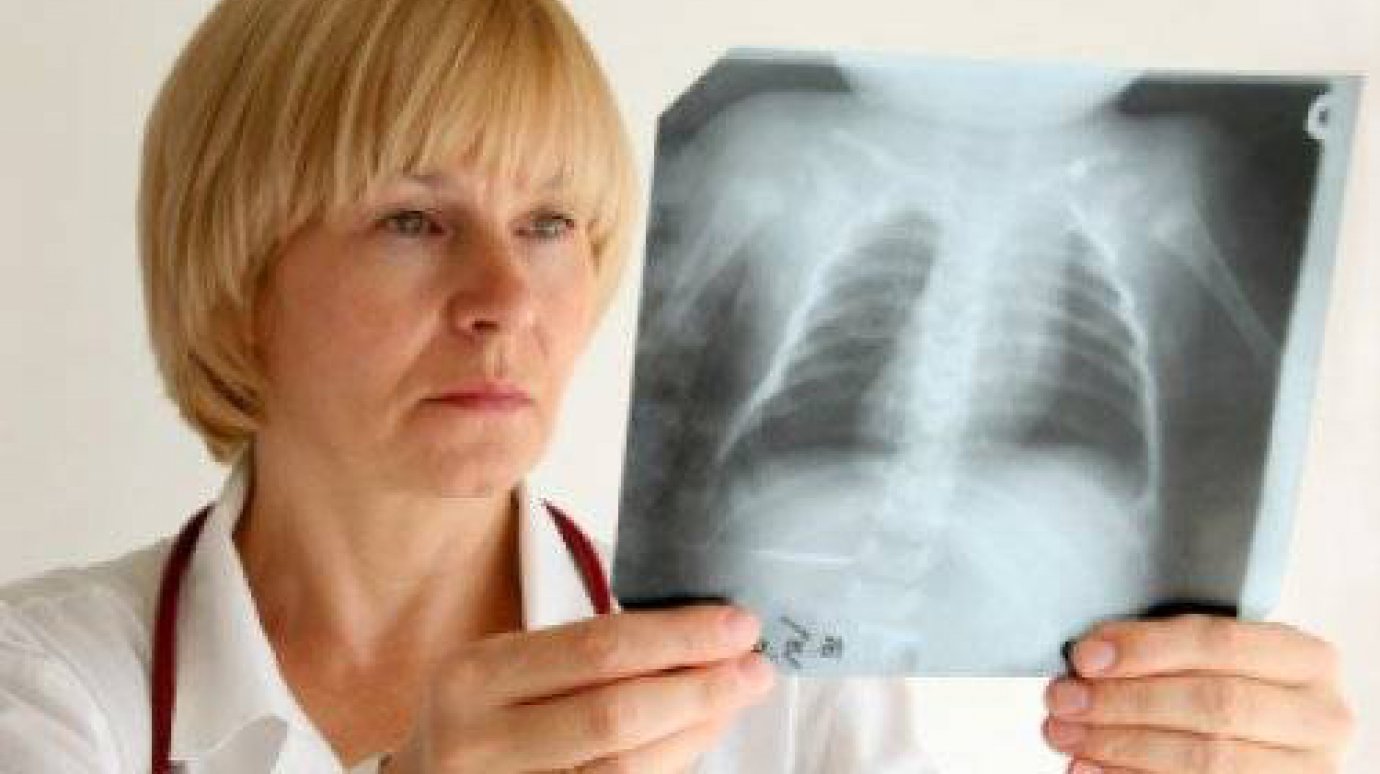 С начала года в области выявлено 10 случаев завозного туберкулеза