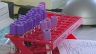 Пензенские медики ждут новую вакцину от ВИЧ-инфекции
