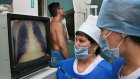 В центре Пензы медики расскажут горожанам о профилактике туберкулеза