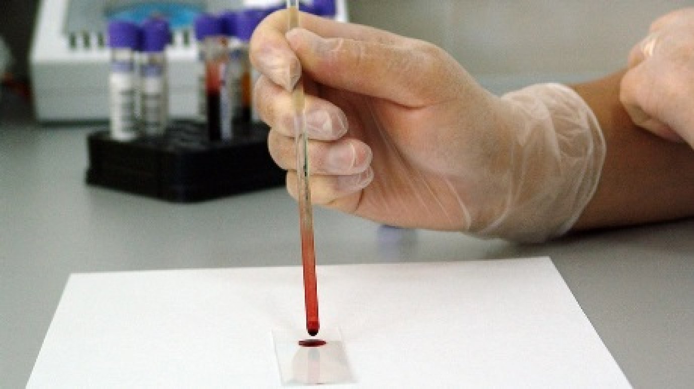 В Пензенской области за 3 месяца умерли 30 ВИЧ-инфицированных