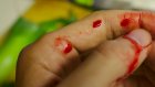 24-летний житель Пензы откусил палец 54-летней родственнице