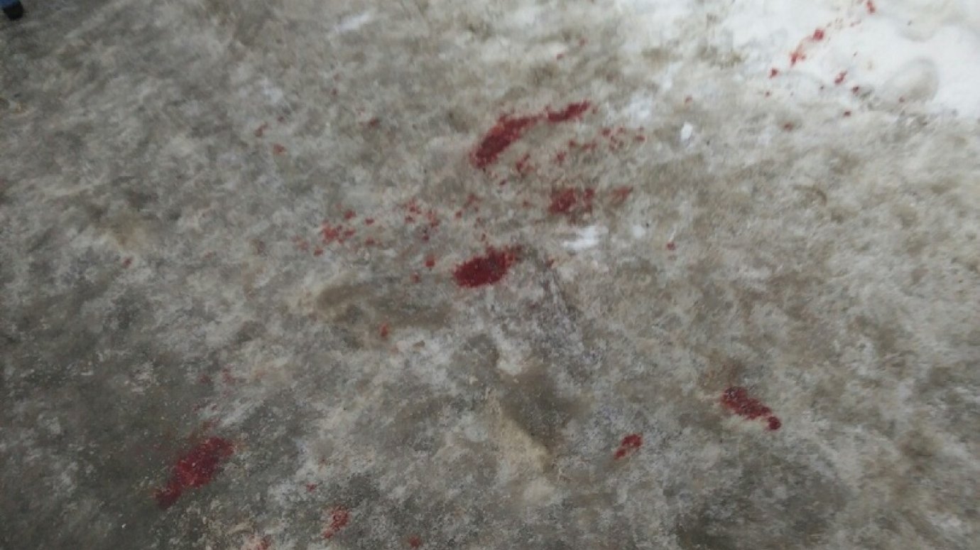 Кровь на улице Суворова: пензенца пырнули ножом во время драки