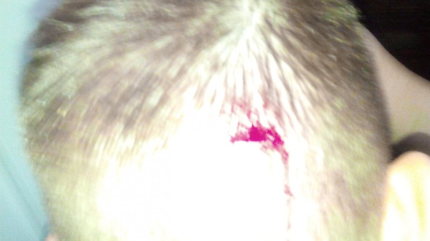 Подросток получил травму в батутном парке на улице Коммунистической