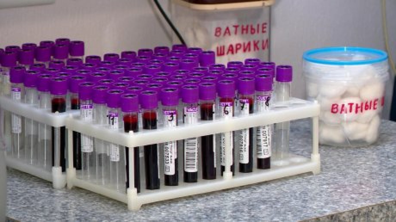 24 июля пензенцев будут бесплатно проверять на гепатит В и С