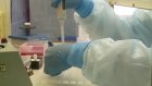 В Пензе зарегистрировали полсотни новых случаев коронавируса