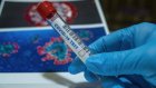 В области не хватает специалистов для тестирования на коронавирус