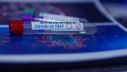 Пензенцев волнует отсутствие теста на антитела перед прививкой от COVID