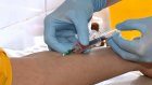 Роспотребнадзор оценил риски завоза нового неизвестного гепатита в Россию
