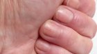 Ученые выявили стратегию борьбы с желанием грызть ногти