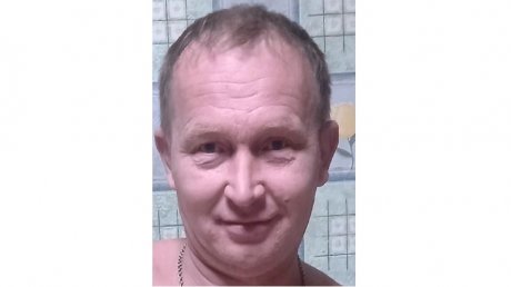 В Пензе разыскивают 43-летнего мужчину без верхних зубов