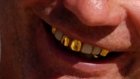 Собутыльник похитил у жителя Пензы золотые зубные коронки