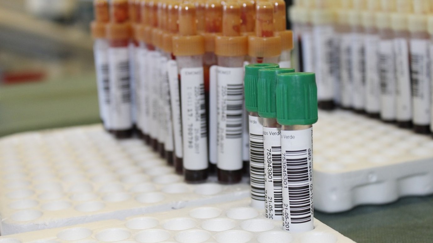Пензенцев приглашают сдать кровь в рамках акции «Стоп ВИЧ/СПИД»