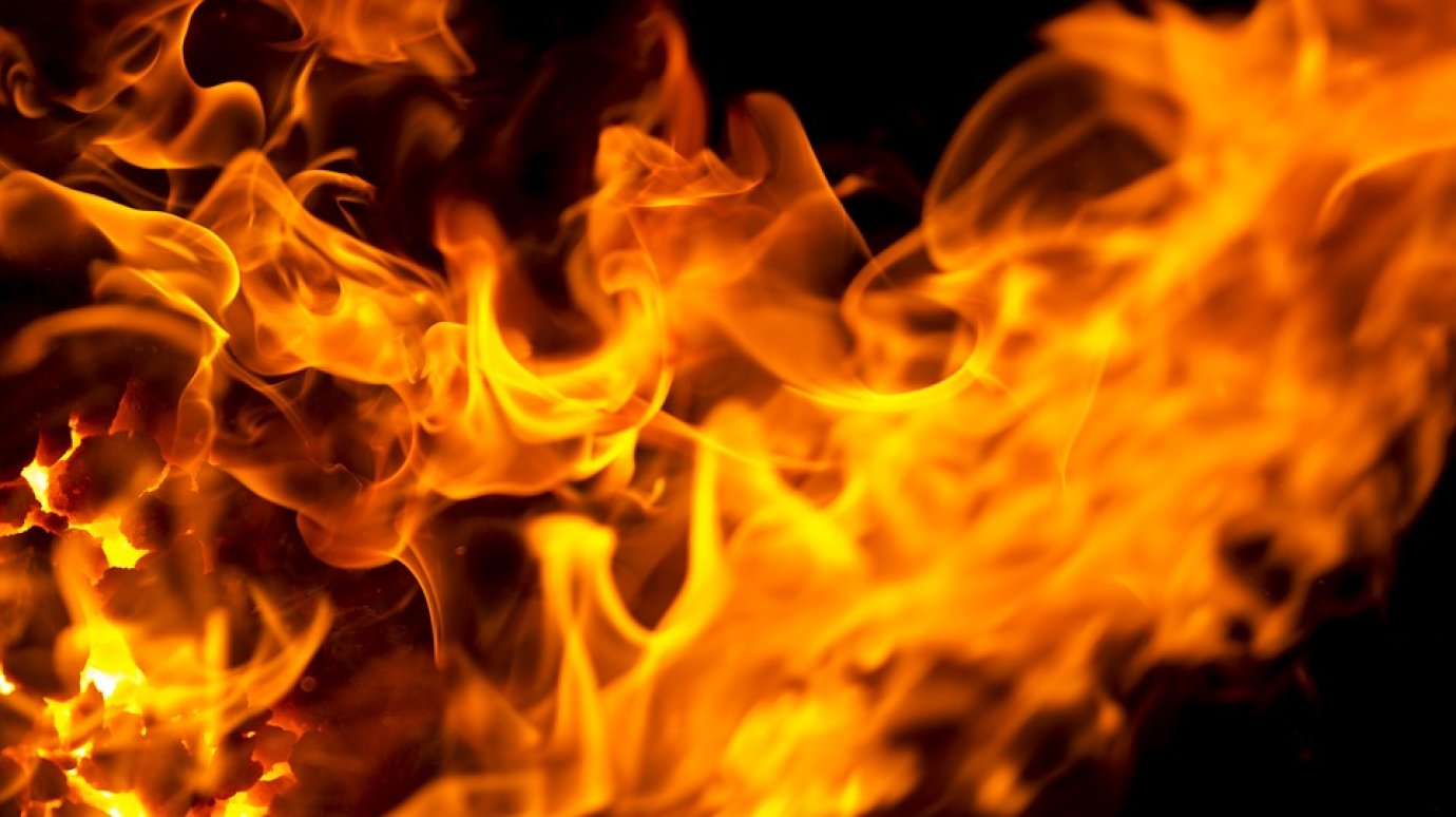 В Пензе при пожаре пострадал хозяин частного дома