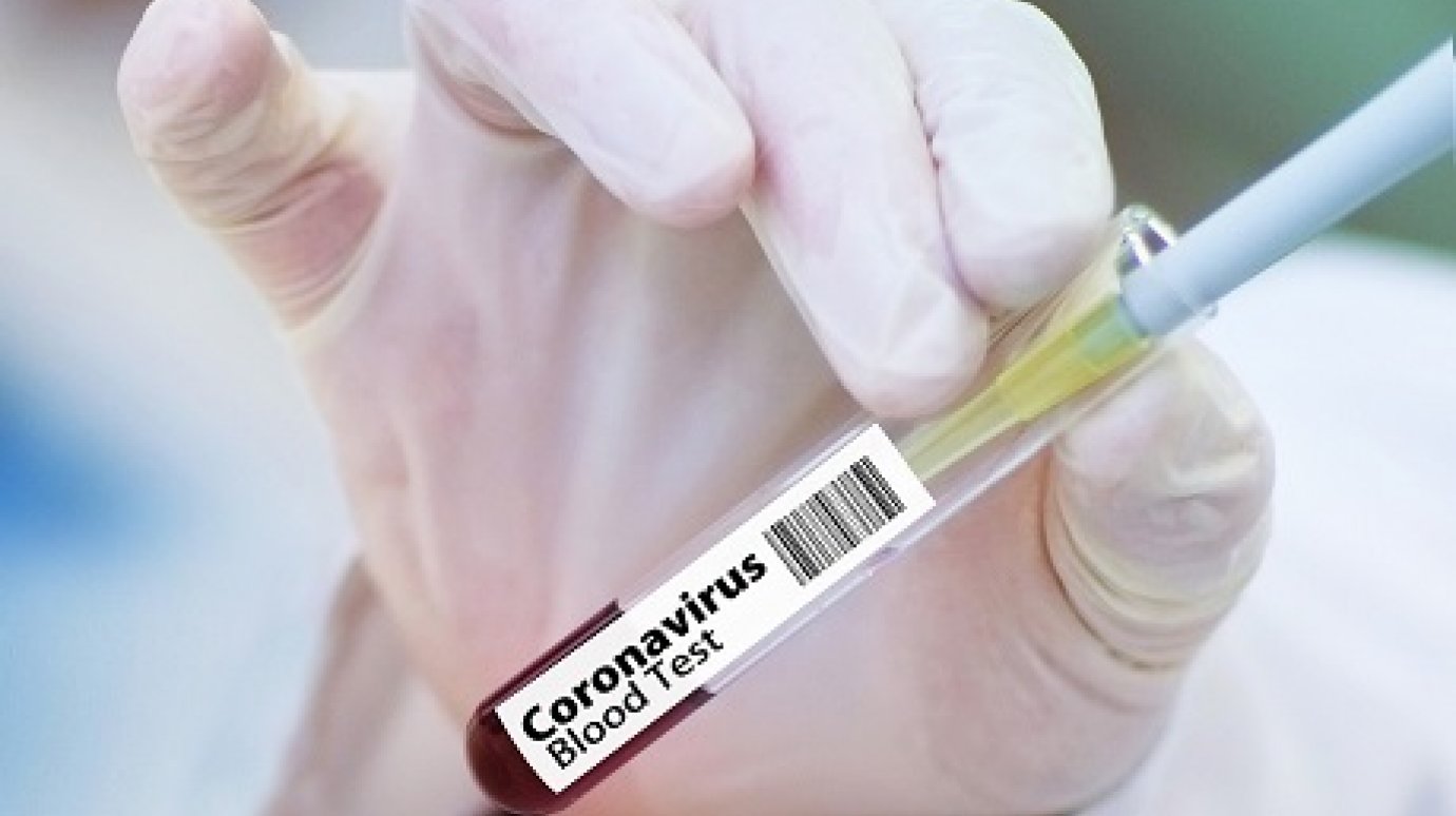Опубликованы данные о новых случаях коронавируса в Пензенской области
