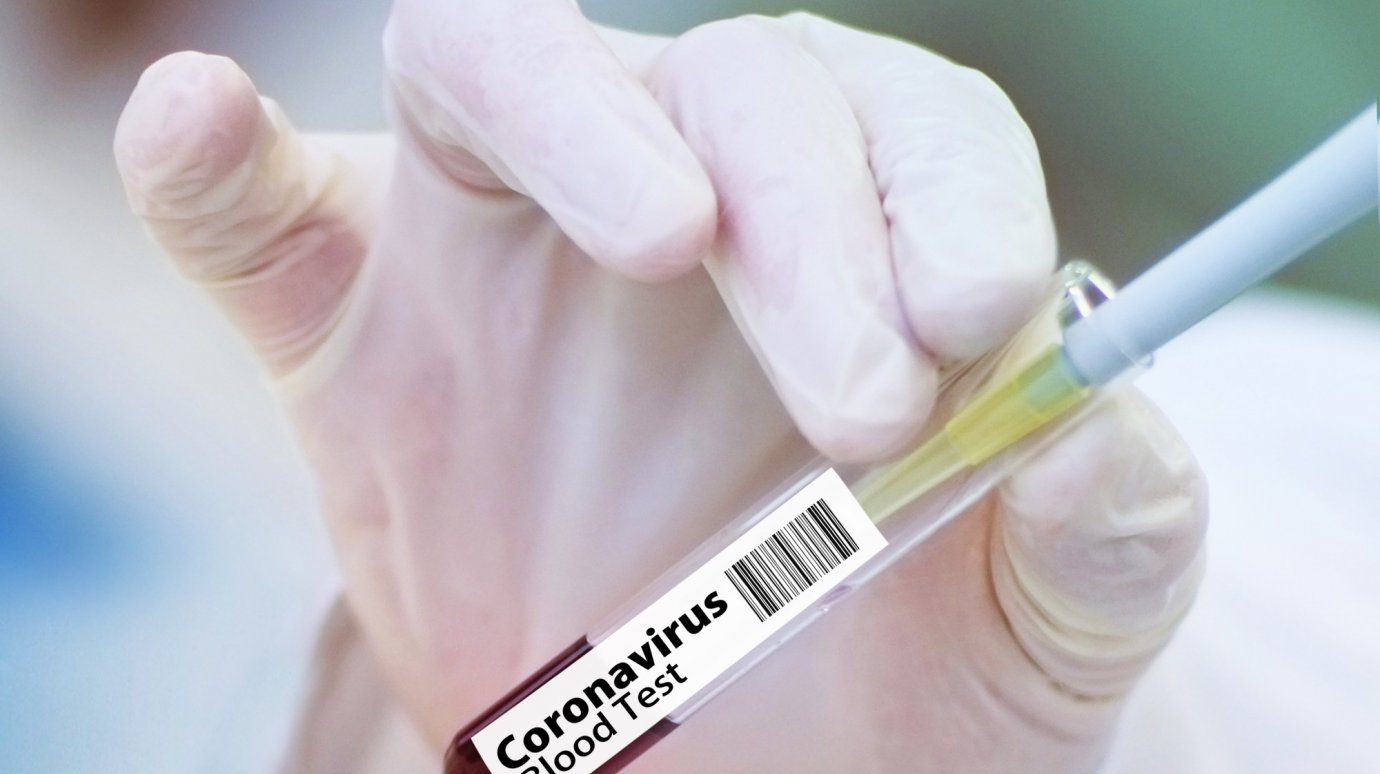 В Кузнецке за неделю выросло число случаев коронавируса