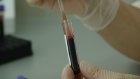 В Пензе организуют бесплатное обследование на ВИЧ-инфекцию