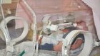 В Пензе успешно прооперировали новорожденного малыша из Чувашии