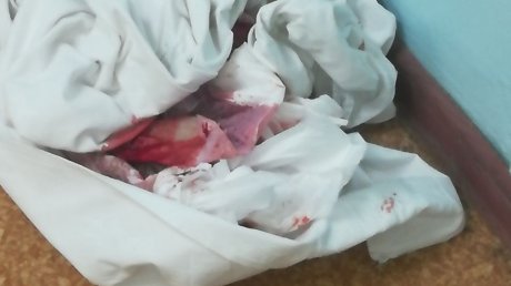 Жалоба на кровавые простыни на полу больницы № 6 разозлила пензенцев