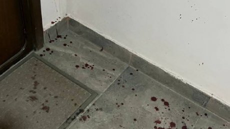 На улице Рахманинова в Пензе в подъезде избили женщину