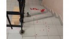 В Пензе третьеклассник разбил голову на лестнице в гимназии