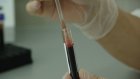 Названы 10 красноречивых признаков проблем с гормонами