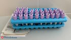 Кузнецк оказался в лидерах по числу ВИЧ-инфицированных