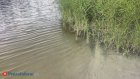 Врач предупредила россиян о живущей в некоторых водоемах пожирающей мозг амебе