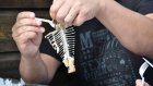 Случайно проглоченная рыбная кость проткнула женщине шею изнутри