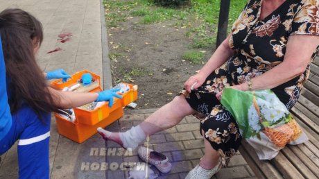 Глава СКР отреагировал на нападение собаки на пенсионерку в Пензе