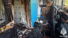 В Кузнецке при пожаре пострадал 70-летний мужчина