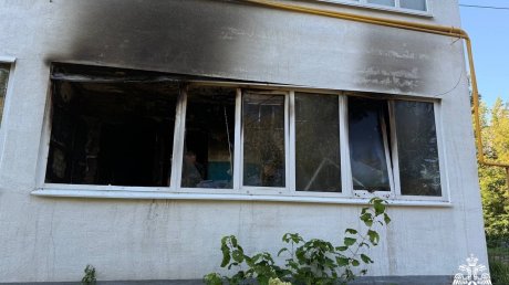 В Кузнецке при пожаре пострадал 70-летний мужчина