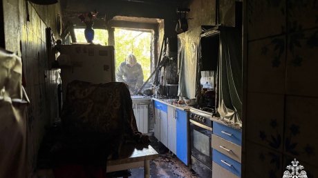 В Кузнецке при пожаре пострадал 70-летний мужчина