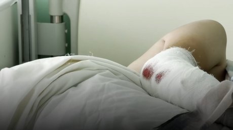 Чудом выжившие в ДТП с питбайками дети рассказали свои истории