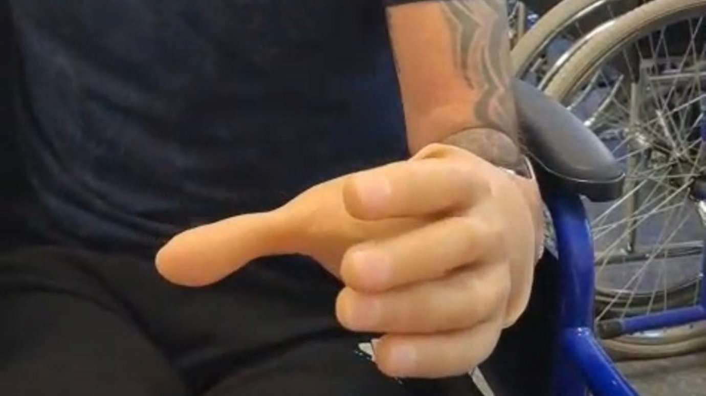 Участнику СВО из Пензенской области установили протезы рук и ног