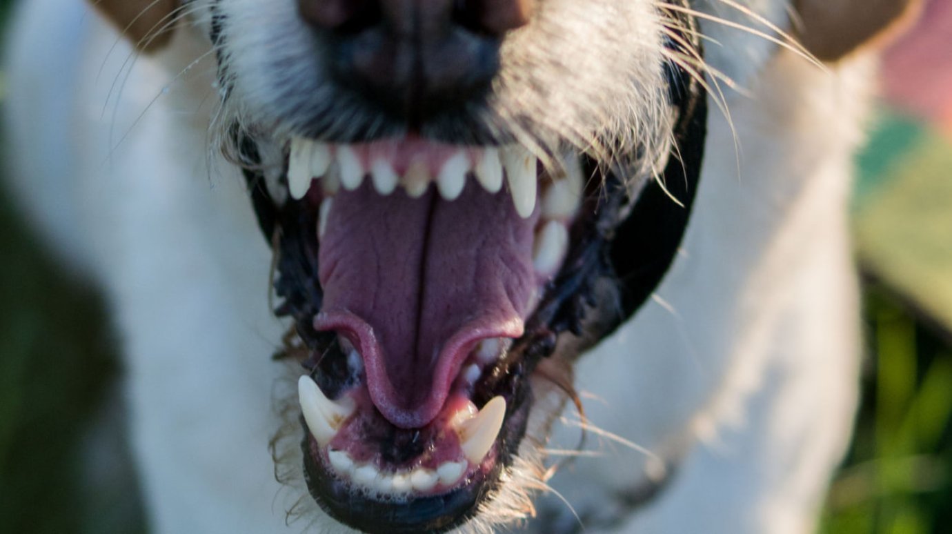 Пострадавшему от агрессивной собаки подростку выплатят 110 000 руб.