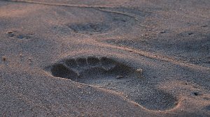 Плоскостопие у взрослых. Что делать?