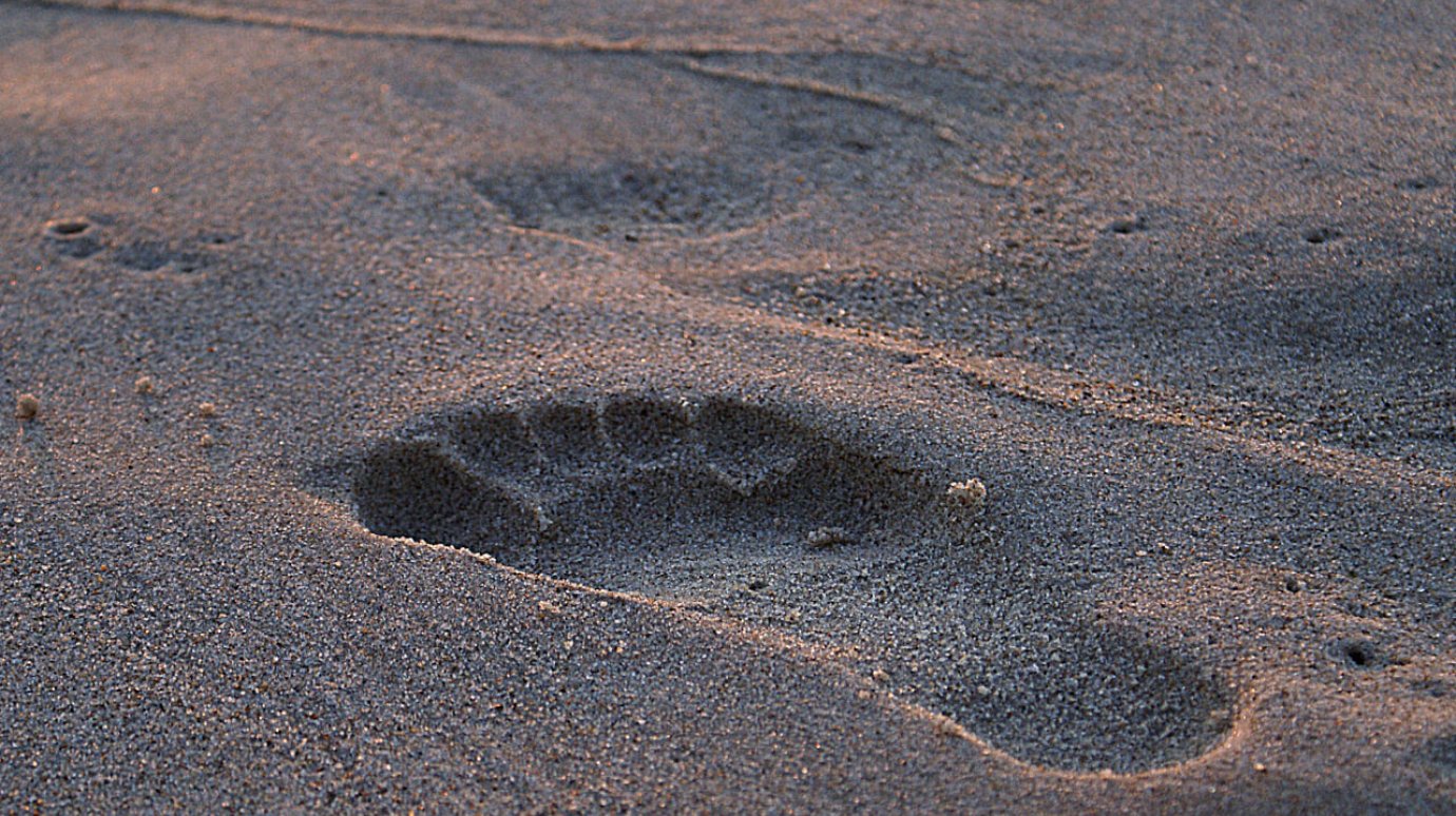 Плоскостопие у взрослых. Что делать?