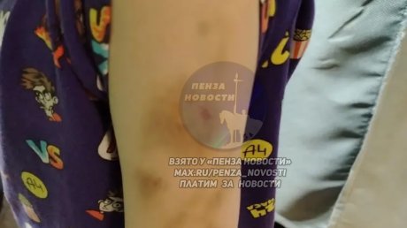 В Пензе изучают обстоятельства избиения первоклассника