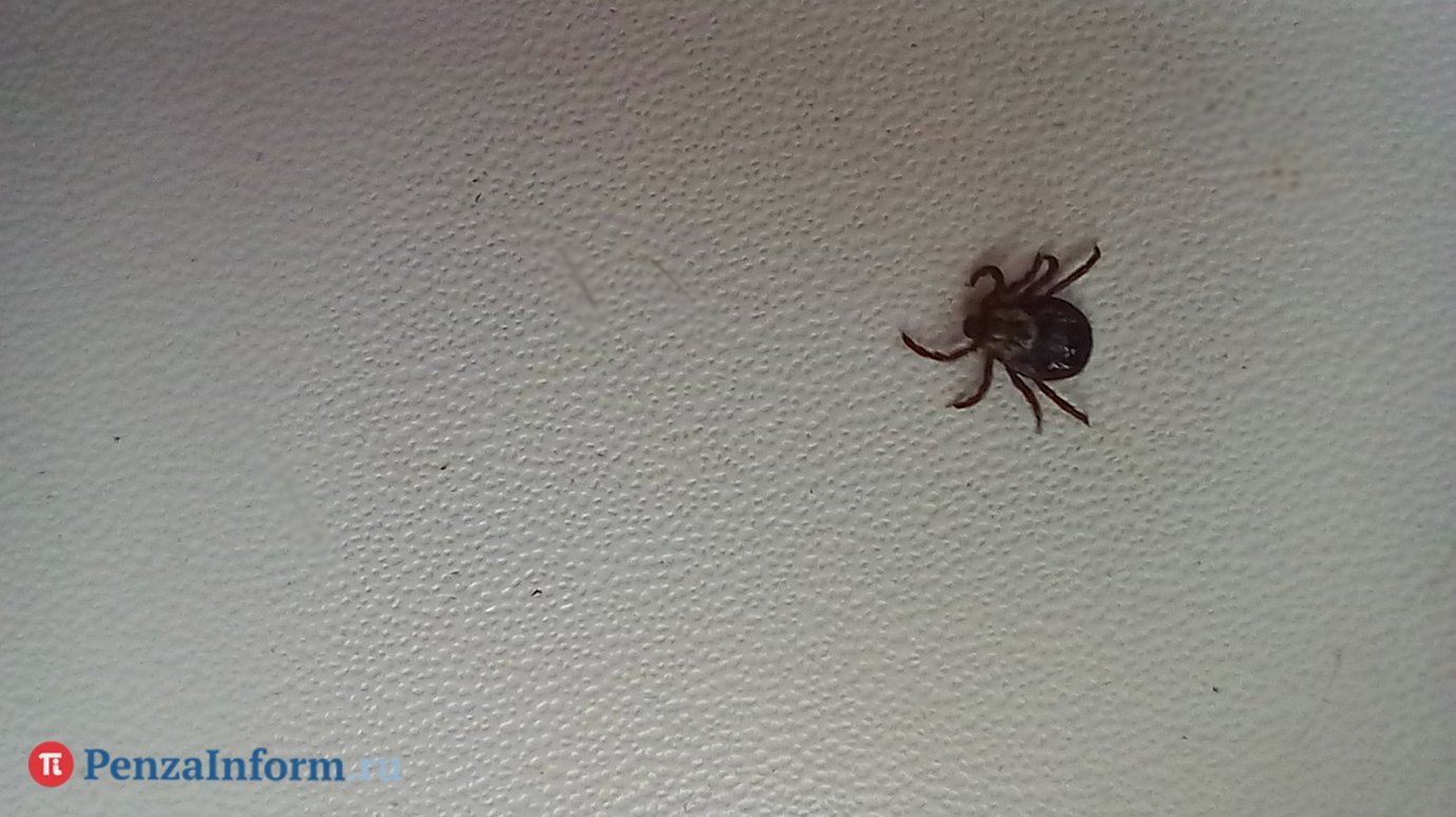 Педиатр: Клеща у ребенка нужно удалять немедленно