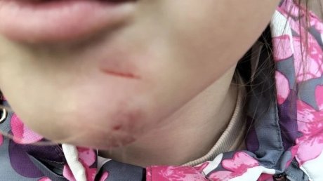 В Ахунах ребенок получил травму на тренажере