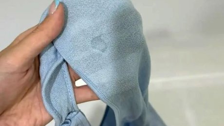 Пензячка рассказала о химическом ожоге, полученном в автобусе