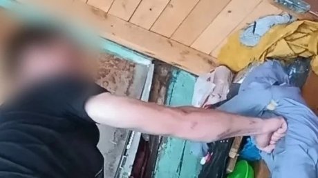 Пензячка скончалась от побоев нетрезвого приятеля